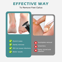 atnayo Electric Foot File Hard Skin Remover, Clean Brush and Foot Sander for Hard Skin Callus Dry