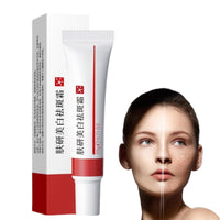 Whitening Freckle Cream,Dark Spot Remover for Face,Freckle Removal Cream,Acne Scar Removal Treatment Crea/m,Skin Lightening Cre/am for Dark Skin,Dark Spot Corrector Cr/eam,Spot C/ream for Women & Men