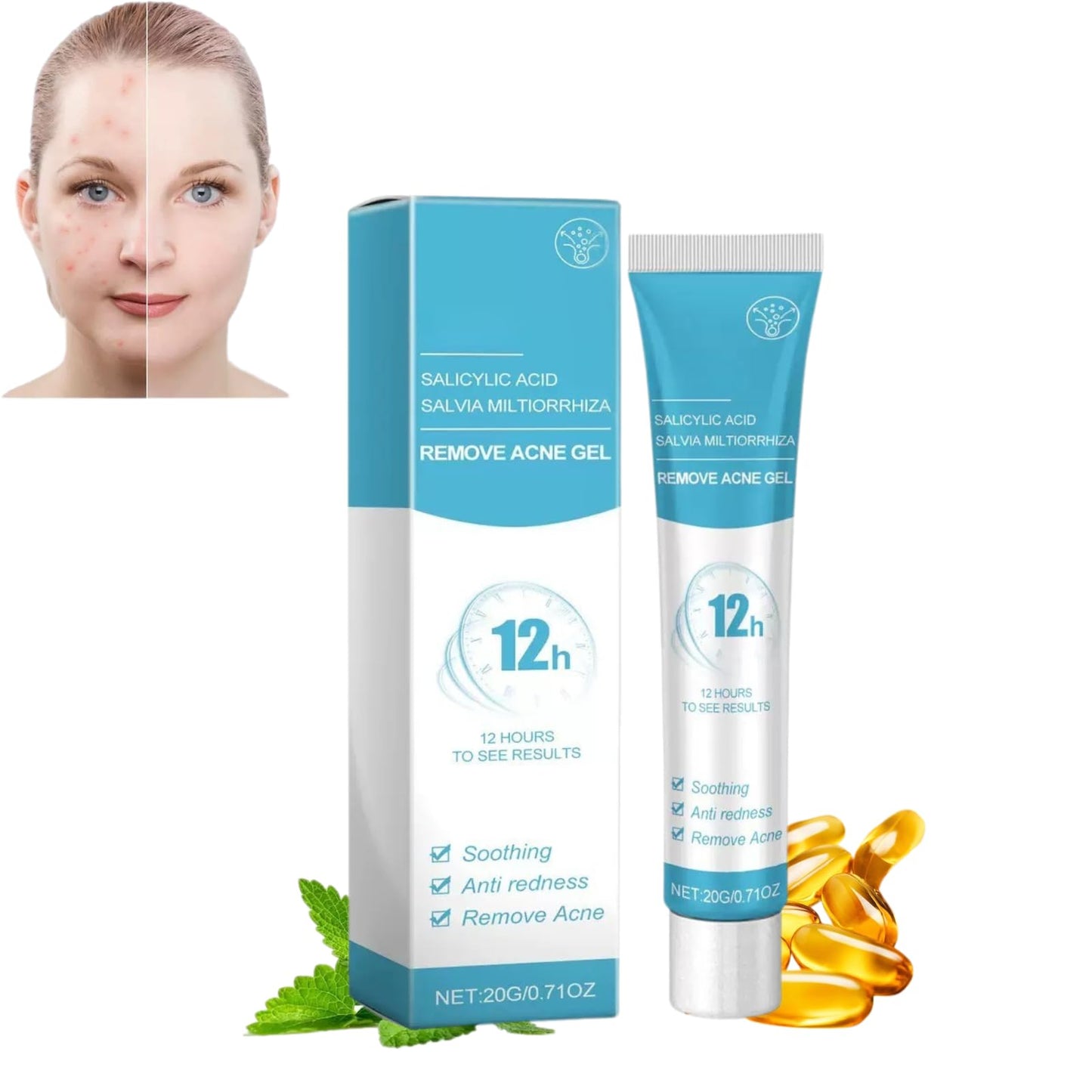 1PCS Acne treatment gel, Anti-Acne Cream, Spot Treatment Pimple Cream,Moisturizing gel for relieving and soothing redness, Acne treatment and spot treatment 20g.