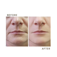 Anti Wrinkle Face Cream - Anti Aging Face Cream with Vitamins A, E, C & Pro-Vitamin B5 - (50ml) - Moisturiser Face Cream - Womens & Mens Anti Aging Face Cream and Moisturiser