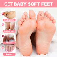 Foot Peel Mask, 3 Pack JVR Feet Exfoliating Mask, Moisturizing Socks, Footskin Care for Callus, Restoring Cracked Heel Dead, Dry, Hard Skin, Baby Soft Smooth Touch (Rose)