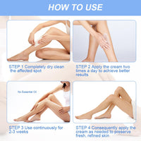 ACWOO Urea Cream 40%, Urea Foot Cream, 150g Urea Cream for Feet, Urea Foot & Hand Cream for Cracked Heels and Dry Skin, Foot Nourishing Frost for Callus Remover, 40% Urea Lotion for Feet