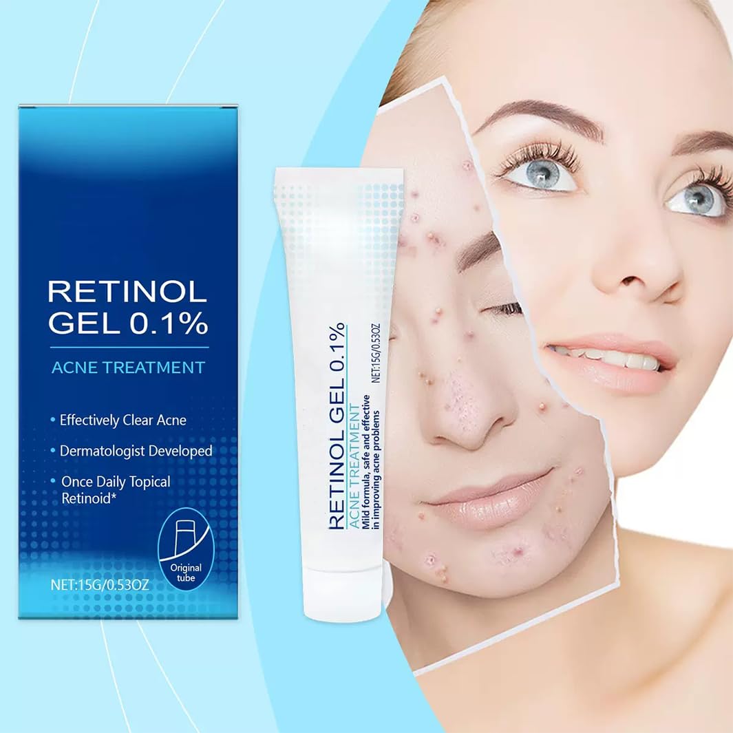 Retinol Gel,Retinol Gel for Face, Retinol Acne Treatment Gel & Skin Soothing Cream,Anti-Acne Moisturizer with Retinol, Spot Treatment for Acne-Prone Skin, Oil-Free,Non-Comedogenic