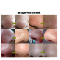 (10 Pcs) Blackhead Remover | Nose Beauty Stickers | Blackhead Acne Removal Pore Cleansing Nose Cleaning Strips | Deep Cleansing Nose Pore Strips For Men & Women (White)