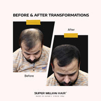 Super Million Hair Fibres - 10g - 15g - 20g - 25g - 40g. (10g, No.2 Dark Brown)