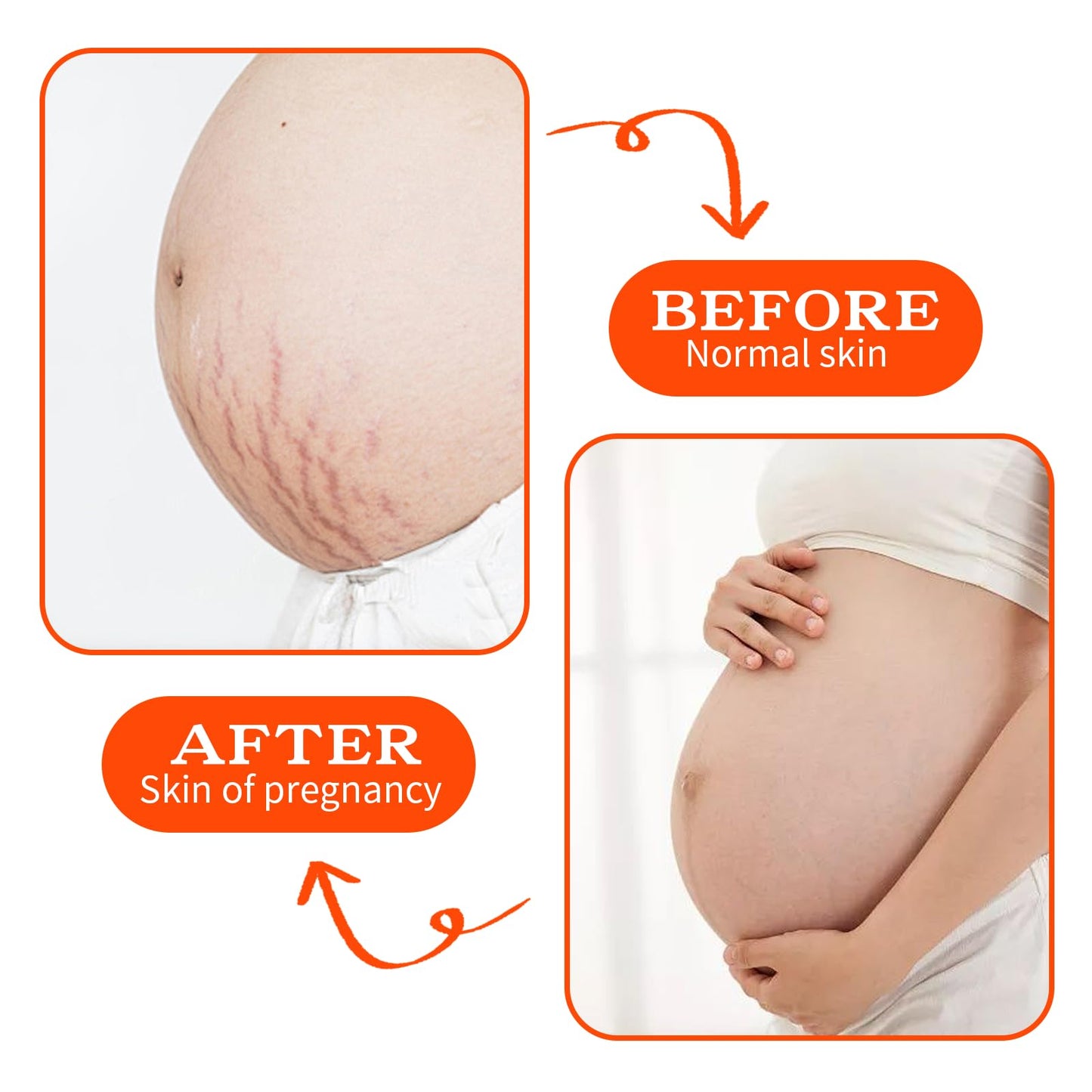 PlusBee Bio Oil Scar Treatment, Collagen Boosting Oil for Scars, Stretch Marks & Uneven Skin Tone, Skincare Serum for Pregnancy, Acne & Surgery Scars, 125ml