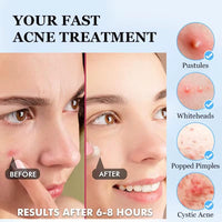Generic Pimple patch