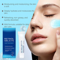 Retinol Gel,Retinol Gel for Face, Retinol Acne Treatment Gel & Skin Soothing Cream,Anti-Acne Moisturizer with Retinol, Spot Treatment for Acne-Prone Skin, Oil-Free,Non-Comedogenic