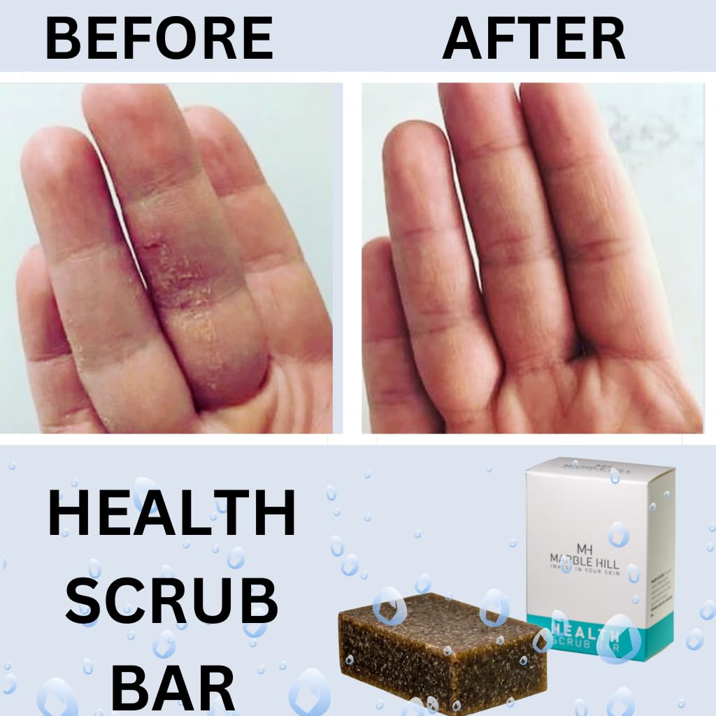 Tea Tree Oil Soap Anti-Fungal Antibacterial for Sweat Rash Ring worm Body Odour Yeast Exfoliating Natural Cleanser Acne Athletes Foot Healthy Feet Skin Nails Marble Hill Health Scrub Bar 100g