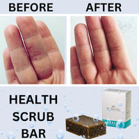 Tea Tree Oil Soap Anti-Fungal Antibacterial for Sweat Rash Ring worm Body Odour Yeast Exfoliating Natural Cleanser Acne Athletes Foot Healthy Feet Skin Nails Marble Hill Health Scrub Bar 100g