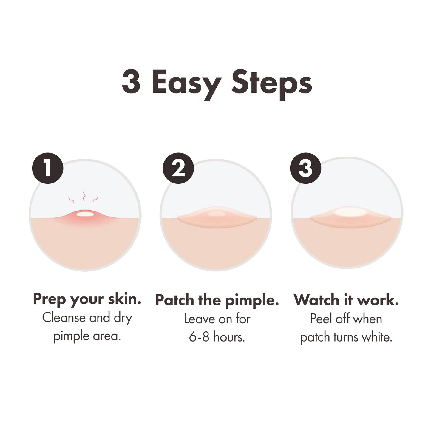 HERO COSMETICS Hero Mighty Pimple Patches Surface XL Spot Patches Acne Treatment 10 Count