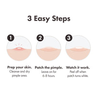 HERO COSMETICS Hero Mighty Pimple Patches Surface XL Spot Patches Acne Treatment 10 Count