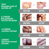 2 Pack Nail Repair Pen, 4ml Nail Care Liquid - Nail Strengthener, Cuticle Oil, Help Strengthen The Nails