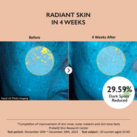 Haruharu Wonder 4% TXA Dark Spot Go Away Serum, 1.01 fl. oz, Niacinamide, Tranexamic Acid, Vitamin C & Centella