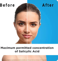 Generic Salicylic Acid Exfoliating Face Wash (Pack of 2) – Clearer Skin from Day 1 | Unclogs Pores, Controls Oil & Shine | Cruelty-Free & Dermatologist Approved