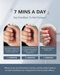 KTS Fungal Nail Treatment,Anti Fungal Nail Treatment For Toenails Extra Strong Laser Device,7 Mins Per Day Blue Light Nail Fungus Treatment For Toenail,Toe Nail Fungal Treatment At Home