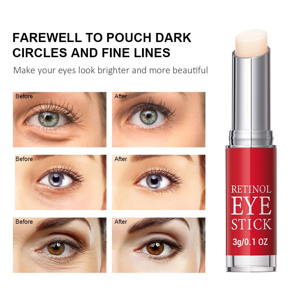 QEEROYO Retinol Eye Stick, Retinol Eye Cream, Eye Balm Stick, Eye Cream for Puffiness, Retinol Eye Cream for Dark Circles, Eye Brightener Stick for Dark Circles, Smoothens Wrinkle Eye Cream