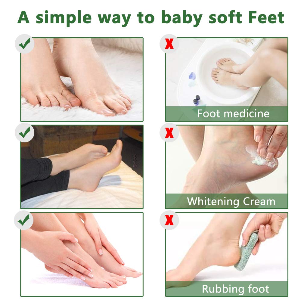 IDUCEN Foot Mask 2 Pack, (Tea Tree) Foot Peel Mask Callus Remover, Exfoliating Peeling Calluses Dead Skin, Callus Remover Foot Mask, Baby Soft Smooth Touch Feet-Men Women Exfoliating Foot Mask