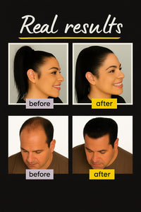THICKIFY Hair Fibres for Thinning Undetectable & Natural - 28g Bottle - Completely Conceals Loss Instantly - Thickener Topper Fine Women Men (Light Blonde), Number Of Items: 1