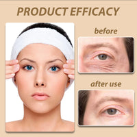 Snail Peptide Eye Cream Stick, Hydrating Under Eye Balm, Dark Circle and Puffiness Treatment, Collagen Moisturizer for Eye Bags, Easy Application, Travel Size, 3g