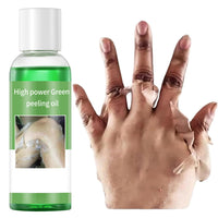 IREV Exfoliating Peeling Oil, Foot Peel Oil for Dry Dead Skin, Gentle Body Exfoliating for Women and Men