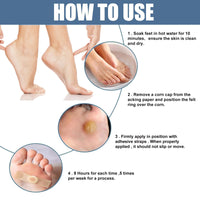 Ruojiar 24Pcs Verruca Treatment Corn Plasters,Wart Remover,Corn Remover for Feet and Hand,Gentle and Safe Verruca Plasters,Wart Removal Patches,Foot Care for Women and Men,Pain Relief,Gentle and Skin-friendly