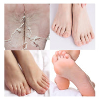 PALMARISA Palmarisa Foot Peel Mask – Exfoliating Socks for Cracked Heels & Hard Skin – Aloe Vera & Tea Tree – 2 Pairs – Baby Soft Feet in 10-14 Days, Dermatologically Tested