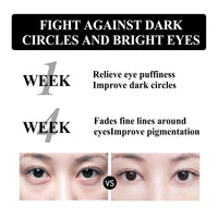 gcdat Retinol Snake Venom Peptide Eye Cream, Firming Eye Cream, Anti Ageing Eye Cream, Under Eye Cream For Puffiness and Bags Reduces Fine Lines
