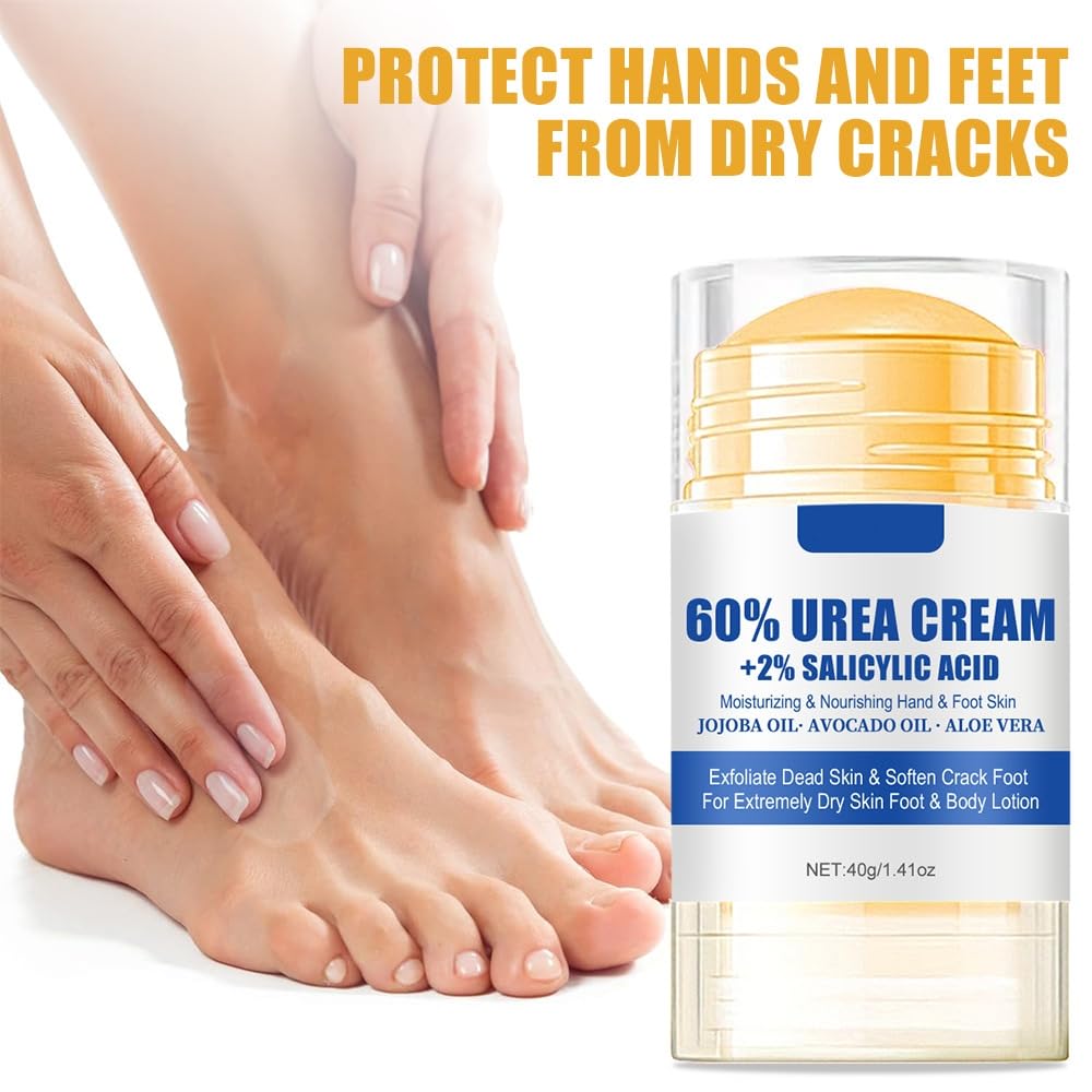 HOPHAT 60% Urea Cream with 2% Salicylic Acid – Avocado Oil & Aloe Vear Moisturizer Foot & Hand Cream for Cracked Heels and Dry Skin
