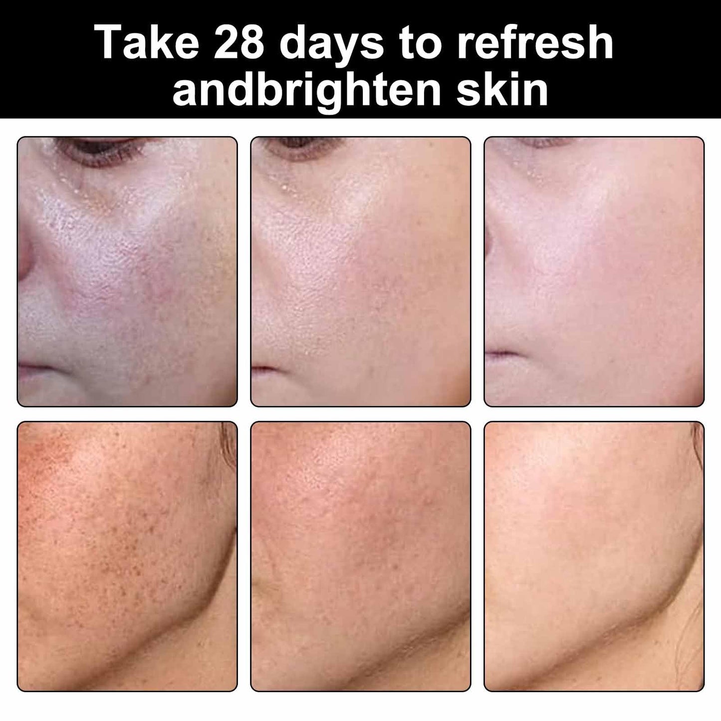Mxlfdc Dark Spot Remover for Face，-Age Spot Remover -Hyperpigmentation Treatment-Sun Spots and Melasma Treatment Cream for Face, Pigmentation Freckle Removal Cream