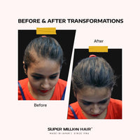 Super Million Hair Fibres - 10g - 15g - 20g - 25g - 40g. (10g, No.2 Dark Brown)