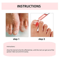 Ingrown Toenail Treatment Drop,Nail Growth Ingrowing Toenail Treatment,Cuticle Care Oils for Ingrown Toenails,Nail Growth Treatment,Ingrowing Toe Nail Treatment,Toe Nail Fungus Treatment Cuticle Oil