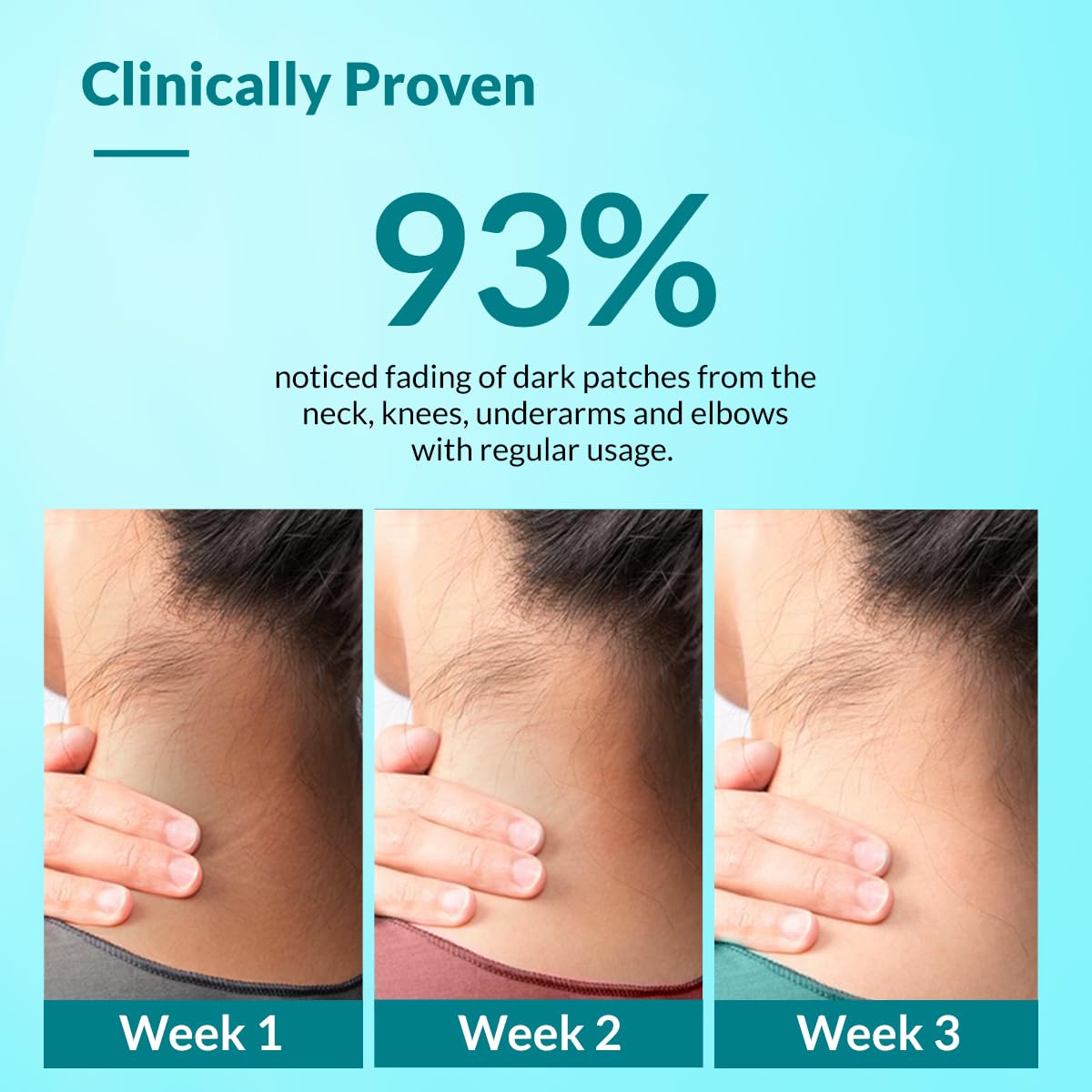 FIXDERMA Fixderma Nigrifix Cream for Acanthosis Nigricans | Whitening and Lightening Solution for Underarm, Knees, Elbows & Knuckles | Dermatologist Tested - 1.76 OZ