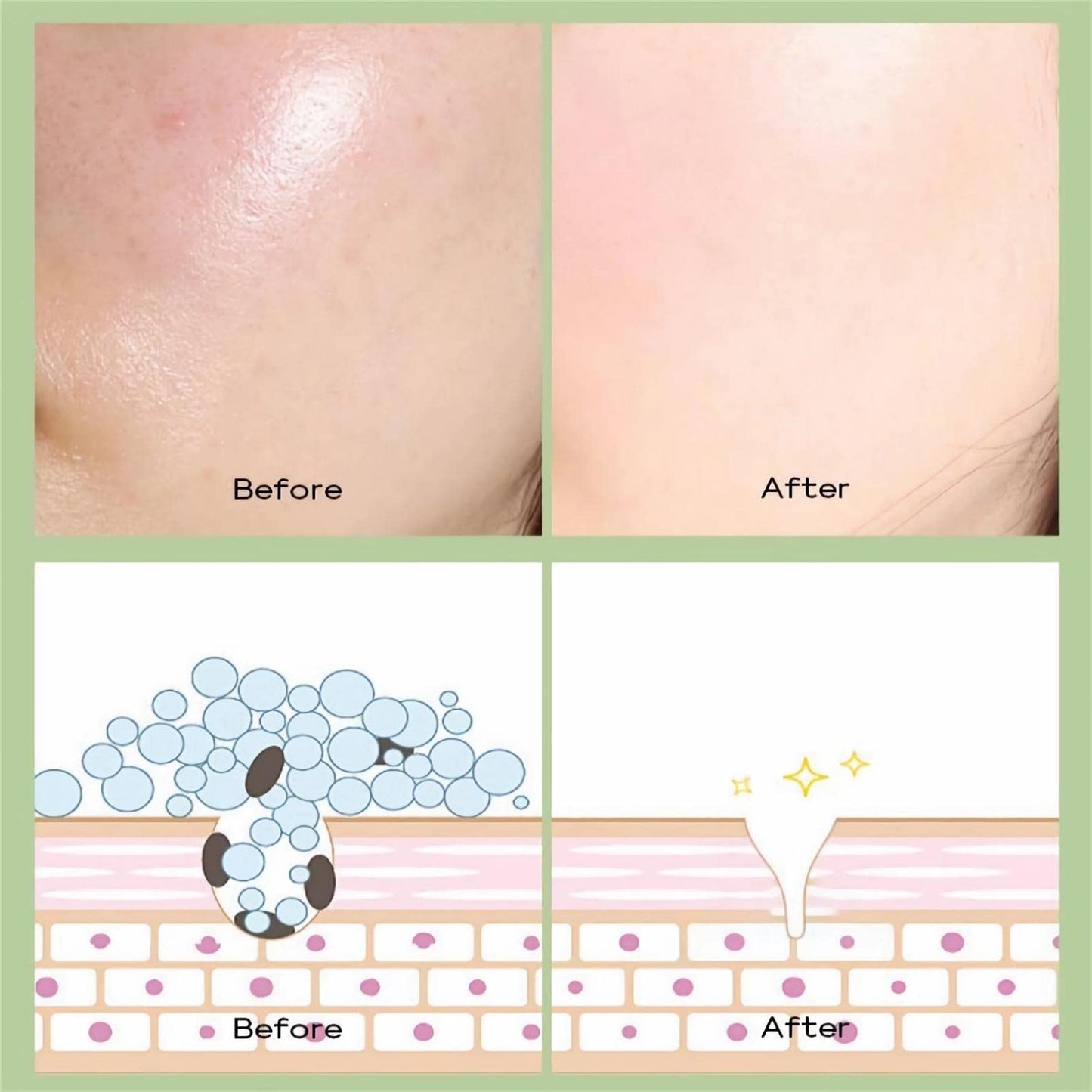 mercham 10 PCS Clay Mask, Green Tea Deep Cleanse Mud Mask, Hydrating, Detoxifying, Pore Tightening, Anti-Acne Clay Face Masks, Natural Plant Extracts, Face Masks Skincare for All Skin Types 5ML*10