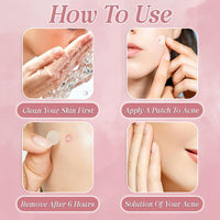 FADII Pimple Patches Pack Of 120 Hydrocolloid Spot Patches Fast-Acting Salicylic Acid Acne Patches Vegan & Cruelty Free Pimple Patch Clear Spot Stickers for Face