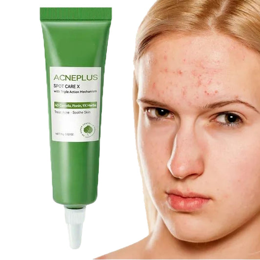 Anti Acne Face Cream,Gentle Acne Cream for Acne Prone Skin,Anti Acne Removal Cream with Plant Extract,Moisturiser Face Cream for Acne Mark,Fade Acne Mark & Calm Acne Redness,Scar Removal Cream