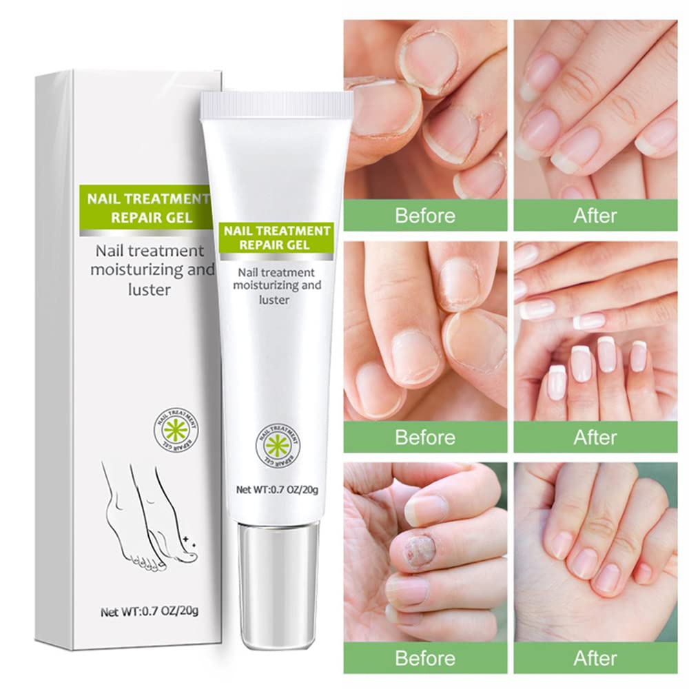 Nail Repair - Nail Treatment Repair Gel/Nail & Toenail Treatment Nail Repair Cream/Toe Be Health Instant Beauty Cream, Renews Yellow, Cracked, Damaged and Split Nails