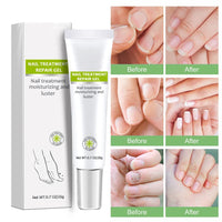 Nail Repair - Nail Treatment Repair Gel/Nail & Toenail Treatment Nail Repair Cream/Toe Be Health Instant Beauty Cream, Renews Yellow, Cracked, Damaged and Split Nails