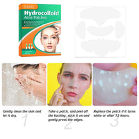 1 Box Acne Patch for Covering Large Breakouts Large Pimple Patch Spot Control Cover Hydrocolloid Acne Patch for Body Cheek Forehead Chin Effectively Calms Relieves Acne