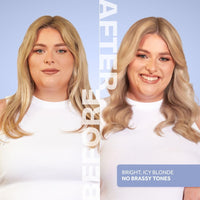 Lee Stafford Blue Pigment Toning Hair Treatments | Bleach Blondes Ice White Hot Shots - Power Dose Treatments, Corrects Brassy & Orange Tones, Great for Highlighted, Cool Hair, 4 x 15ml Doses