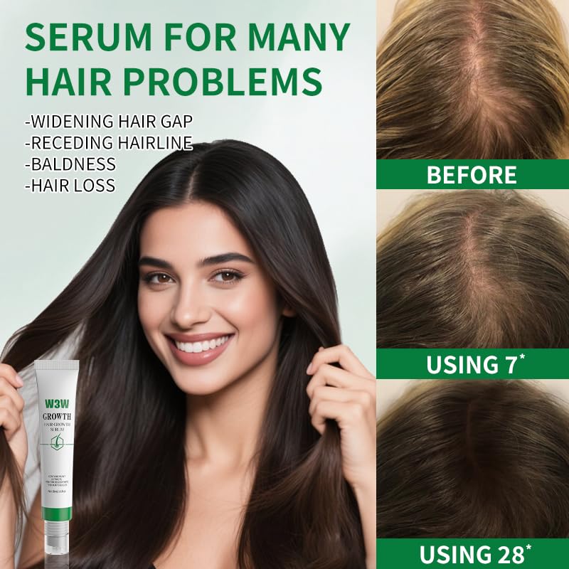 YIAE Herbal Hair Growth Serum with 3-Roller - Caffeine Complex for Thinning Hair, 30ml Lightweight - Gentle Sensitive Scalp