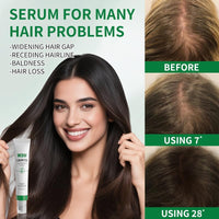 YIAE Herbal Hair Growth Serum with 3-Roller - Caffeine Complex for Thinning Hair, 30ml Lightweight - Gentle Sensitive Scalp
