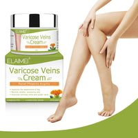 Solotree Varicose Veins Cream, Varicose Vein Treatment, Spider Vein Treatment Cream for Legs, Improve Blood Circulation, Tired and Heavy Legs Fast Relief