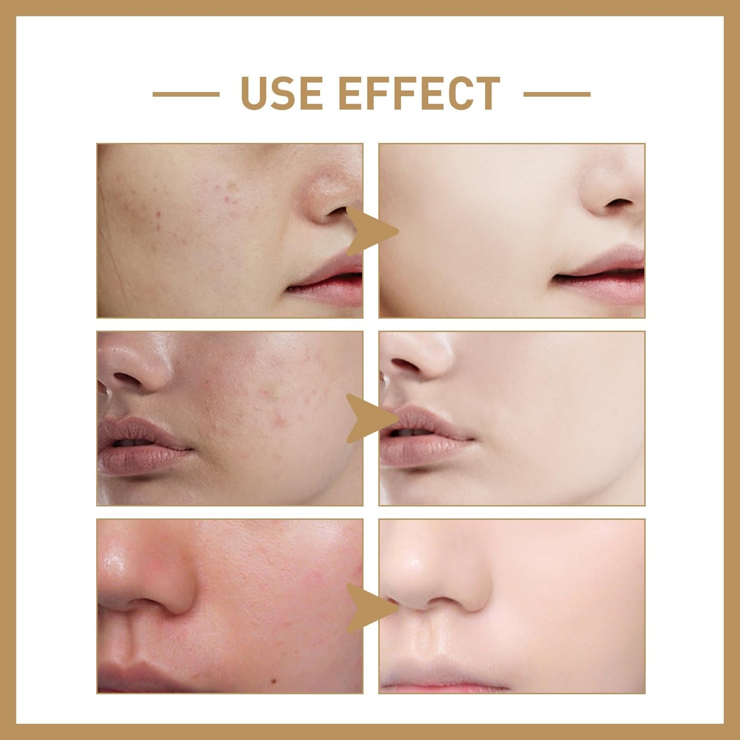 VC Toner,Face VC Skin Toner,VC Soothing Tone/r,V/C Moisturizing to-ner Hydrating Refreshing,Vita/min C Moisturizing Ton/er,Face Astringents and to/ners,Brightening Essence to Enhance Skin Elasticity