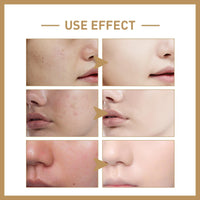 Siyinzu Vitamin C Multi Balm Stick,Brightening Serum Stick,Hydrating Serum Stick,Anti Wrinkle Seru-m S-tick,Balm Stick to Reduce Fine Lines,Vitamin C Eye B-alm Stic-k for Dark Circles,Dark Spot Remover