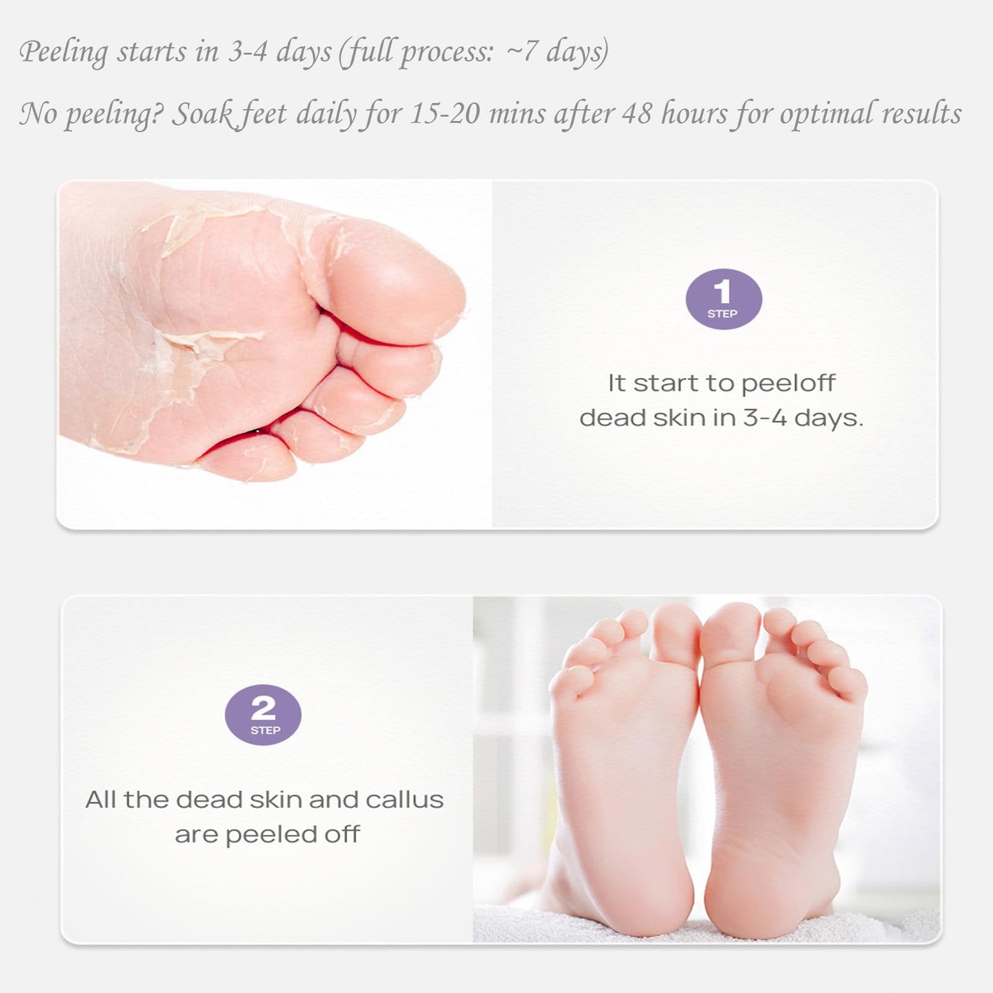 OlymGrow 2-Pack Foot Peel Mask – Callus Remover & Exfoliator for Soft, Smooth Feet, Repair Cracked Heels, Remove Dead Skin, Peeling Foot Mask for Hard, Dry Skin