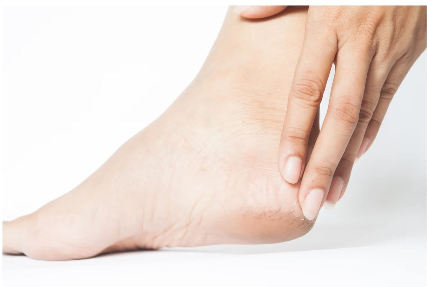 6x Heel Balm