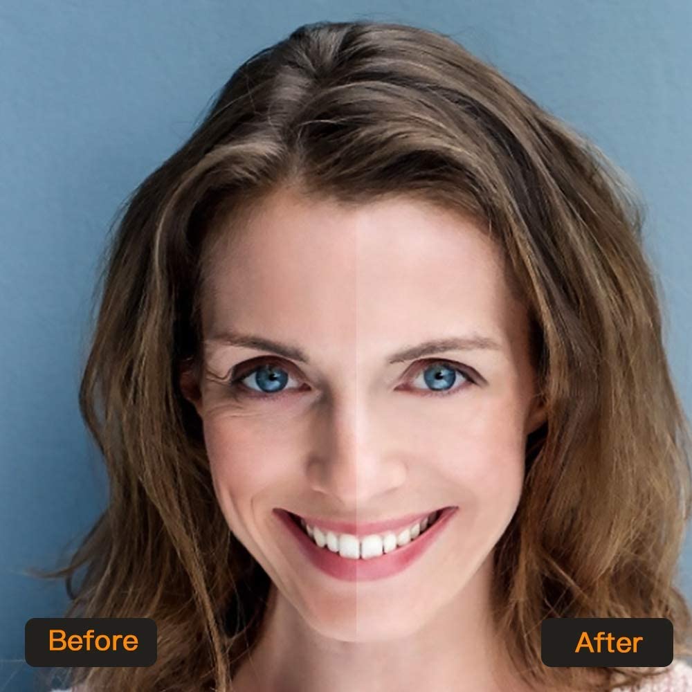 24K Gold Under Eye Treatment Masks, Jiasoval 20 Pairs Natural Gel Collagen Under Eye Patches, Eye Mask for Dark Circles, Remove Eye Bags & Puffy Eyes, Anti-Wrinkle, Hydrating, Soothing