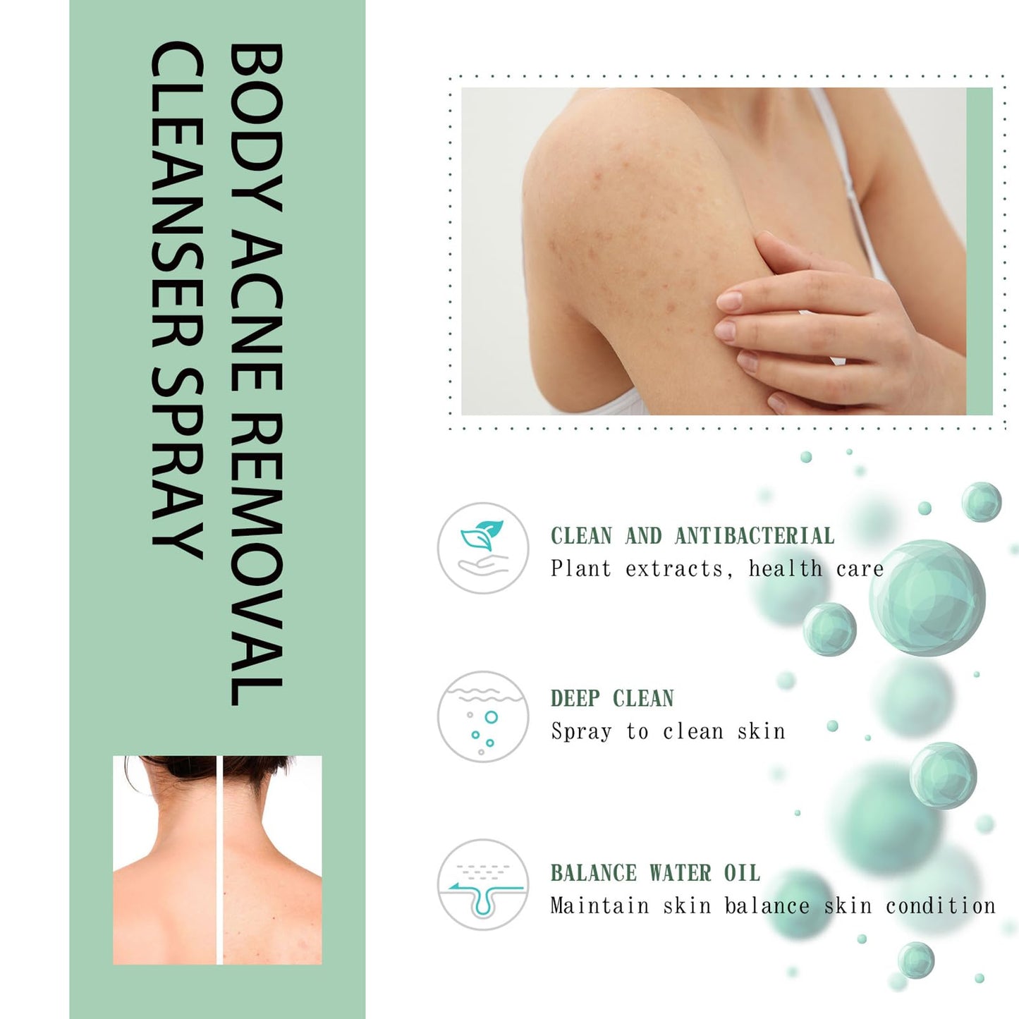 DMQ Acne Treatment Spary,Back Acne Treatment Serum,Body Moisturiser For Acne,Body Moisturiser For Dry Skin,Acne Moisturiser,Reduce Back Acne & Body Acne,Smoothing Moisturiser For Acne Prone Skin-120ml