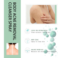 DMQ Acne Treatment Spary,Back Acne Treatment Serum,Body Moisturiser For Acne,Body Moisturiser For Dry Skin,Acne Moisturiser,Reduce Back Acne & Body Acne,Smoothing Moisturiser For Acne Prone Skin-120ml